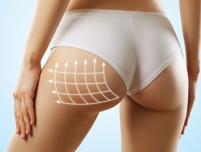 Escort with enhanced butt implants posing confidently