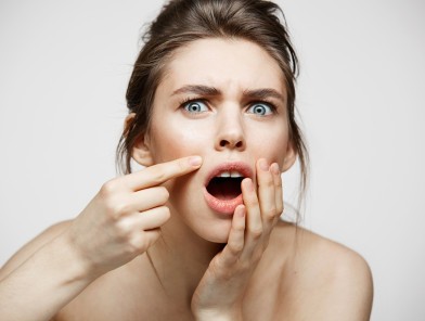 Cold sores management tips for escorts